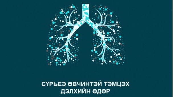 Өнөөдөр дэлхийн сүрьеэтэй тэмцэх өдөр тохиож байна